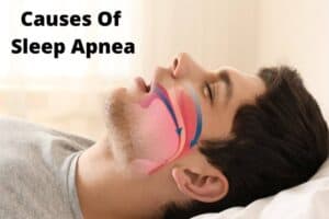 Causes Of Sleep Apnea