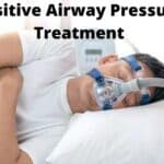 Positive Airway Pressure Treatment