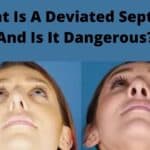 What Is A Deviated Septum, And Is It Dangerous?