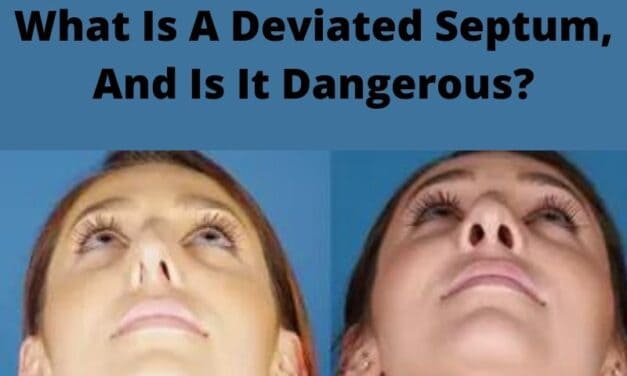 What Is A Deviated Septum, And Is It Dangerous?