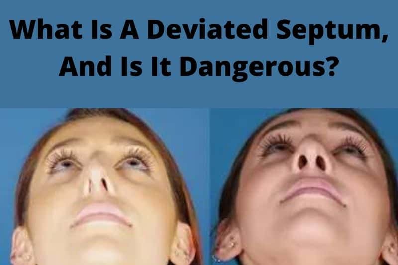 What Is A Deviated Septum, And Is It Dangerous