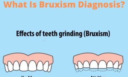 What Is Bruxism Diagnosis?