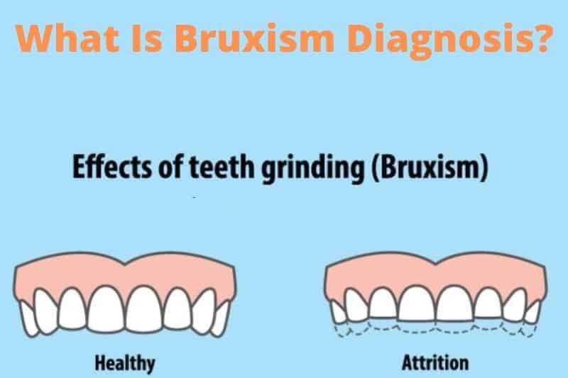 What Is Bruxism Diagnosis